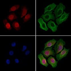 Invitrogen NUP153 Polyclonal Antibody 100 &mu;L; Unconjugated:Antibodies,