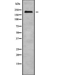 Invitrogen NUP210L Polyclonal Antibody 100 &mu;L; Unconjugated:Antibodies,