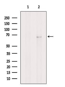 Nurr1 Polyclonal Antibody:Antibodies, Polyclonal
