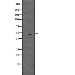 Invitrogen OAS1 Polyclonal Antibody 100 &mu;L; Unconjugated:Antibodies,