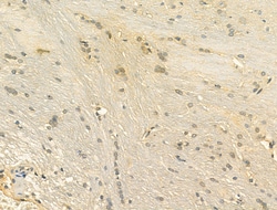 Invitrogen OFD1 Polyclonal Antibody 100 &mu;L | Buy Online | Invitrogen&trade; | Fisher Scientific