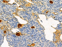 Invitrogen OFD1 Polyclonal Antibody 100 &mu;L | Buy Online | Invitrogen&trade; | Fisher Scientific