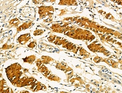 Invitrogen OFD1 Polyclonal Antibody 100 &mu;L | Buy Online | Invitrogen&trade; | Fisher Scientific