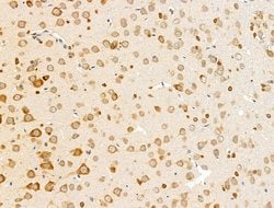 Invitrogen OMP Polyclonal Antibody 100 &mu;L; Unconjugated:Antibodies,