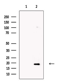 Invitrogen OMP Polyclonal Antibody 100 &mu;L; Unconjugated:Antibodies,