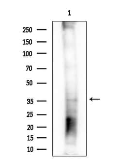 Invitrogen OLIG1 Polyclonal Antibody 100 &mu;L; Unconjugated:Antibodies,
