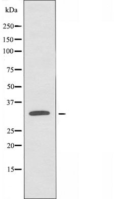 Invitrogen OR2T2/OR2T35 Polyclonal Antibody 100 &mu;L | Buy Online | Invitrogen&trade; | Fisher Scientific