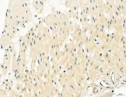Invitrogen OSBP Polyclonal Antibody 100 &mu;L; Unconjugated:Antibodies,