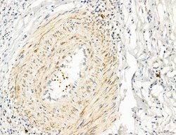 Invitrogen OSBP Polyclonal Antibody 100 &mu;L; Unconjugated:Antibodies,