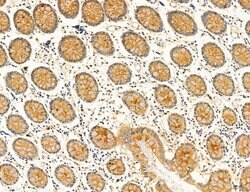 Invitrogen OSBP Polyclonal Antibody 100 &mu;L; Unconjugated:Antibodies,