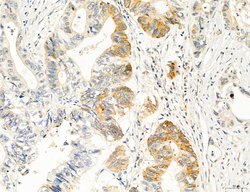 Invitrogen OSBP Polyclonal Antibody 100 &mu;L; Unconjugated:Antibodies,
