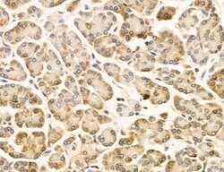 Invitrogen OSBP Polyclonal Antibody 100 &mu;L; Unconjugated:Antibodies,