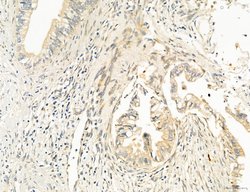 Invitrogen OSBP Polyclonal Antibody 100 &mu;L; Unconjugated:Antibodies,