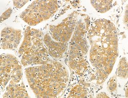 Invitrogen OSBP Polyclonal Antibody 100 &mu;L; Unconjugated:Antibodies,