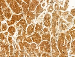Invitrogen OSBP Polyclonal Antibody 100 &mu;L; Unconjugated:Antibodies,