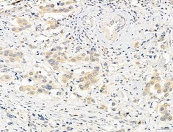 Invitrogen OSBP Polyclonal Antibody 100 &mu;L; Unconjugated:Antibodies,