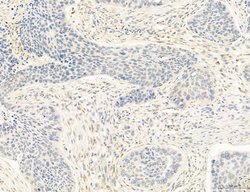 Invitrogen OSBP Polyclonal Antibody 100 &mu;L; Unconjugated:Antibodies,