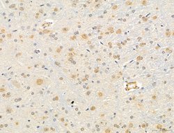 Invitrogen OSBP Polyclonal Antibody 100 &mu;L; Unconjugated:Antibodies,