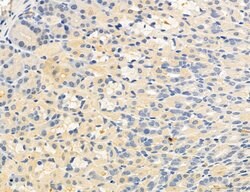 Invitrogen OSBP Polyclonal Antibody 100 &mu;L; Unconjugated:Antibodies,