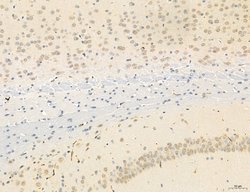 Invitrogen OSBP Polyclonal Antibody 100 &mu;L; Unconjugated:Antibodies,