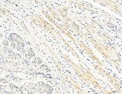 Invitrogen OSBP Polyclonal Antibody 100 &mu;L; Unconjugated:Antibodies,