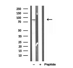 Invitrogen OSBP Polyclonal Antibody 100 &mu;L; Unconjugated:Antibodies,