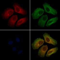 Invitrogen ORP2 Polyclonal Antibody 100 &mu;L; Unconjugated:Antibodies,