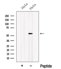 Invitrogen ORP2 Polyclonal Antibody 100 &mu;L; Unconjugated:Antibodies,