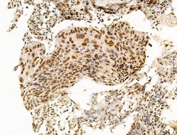 Invitrogen OVOL2 Polyclonal Antibody 100 μL; Unconjugated:Antibodies,