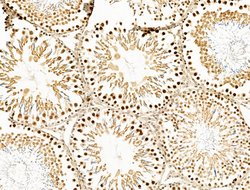 Invitrogen OVOL2 Polyclonal Antibody 100 μL; Unconjugated:Antibodies,
