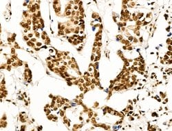 Invitrogen OVOL2 Polyclonal Antibody 100 μL; Unconjugated:Antibodies,