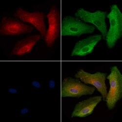 Invitrogen LPAR6 Polyclonal Antibody 100 &mu;L; Unconjugated:Antibodies,