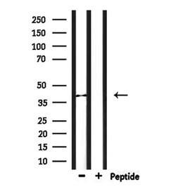 Invitrogen LPAR6 Polyclonal Antibody 100 &mu;L; Unconjugated:Antibodies,