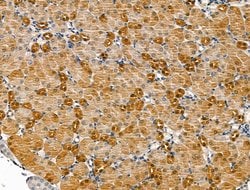 Invitrogen P2X2 Polyclonal Antibody 100 &mu;L; Unconjugated:Antibodies,