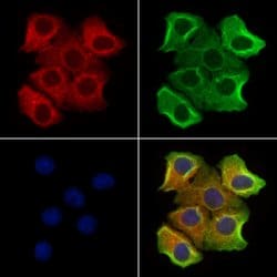 Invitrogen P2X3 Polyclonal Antibody 100 &mu;L; Unconjugated:Antibodies,