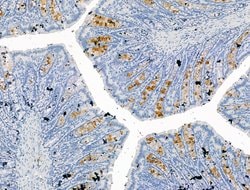 Invitrogen P2X3 Polyclonal Antibody 100 &mu;L; Unconjugated:Antibodies,