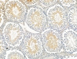 Invitrogen P2X3 Polyclonal Antibody 100 &mu;L; Unconjugated:Antibodies,