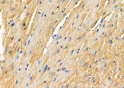 Invitrogen P4HTM Polyclonal Antibody 100 &mu;L; Unconjugated:Antibodies,