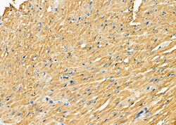 Invitrogen P4HTM Polyclonal Antibody 100 &mu;L; Unconjugated:Antibodies,