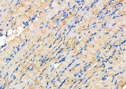 Invitrogen P4HTM Polyclonal Antibody 100 &mu;L; Unconjugated:Antibodies,