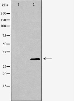 Invitrogen p57 Kip2 Polyclonal Antibody 100 &mu;L | Buy Online | Invitrogen&trade; | Fisher Scientific