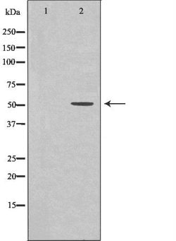 Invitrogen DOK1 Polyclonal Antibody 100 &mu;L; Unconjugated:Antibodies,