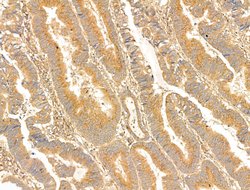 Invitrogen PAG1 Polyclonal Antibody 100 &mu;L; Unconjugated:Antibodies,