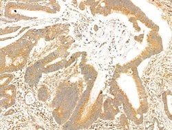 Invitrogen PAG1 Polyclonal Antibody 100 &mu;L; Unconjugated:Antibodies,