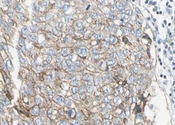 Invitrogen PAI1 Polyclonal Antibody 100 &mu;L; Unconjugated:Antibodies,
