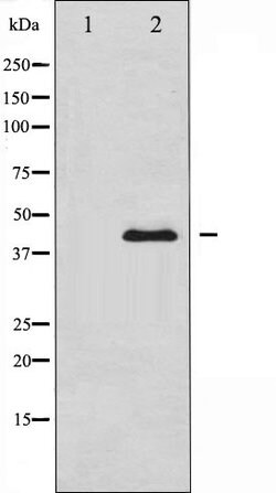 Invitrogen PAI1 Polyclonal Antibody 100 &mu;L; Unconjugated:Antibodies,