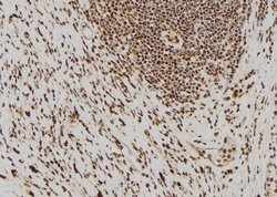 Invitrogen PAK7 Polyclonal Antibody 100 μL; Unconjugated:Antibodies,