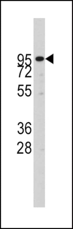 Invitrogen ADAM17 Polyclonal Antibody 400 &mu;L; Unconjugated:Antibodies,