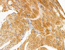 Invitrogen PAPPA2 Polyclonal Antibody 100 &mu;L | Buy Online | Invitrogen&trade; | Fisher Scientific