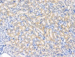 Invitrogen PAPPA2 Polyclonal Antibody 100 &mu;L | Buy Online | Invitrogen&trade; | Fisher Scientific